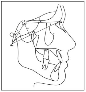 fig 1 maior